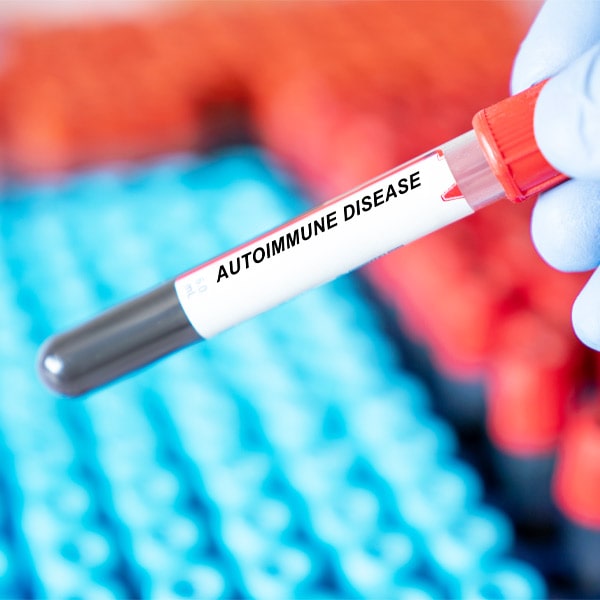 biocore-diagnostics.de-germany-Autoimmune-diseases-Autoimmunerkrankungen